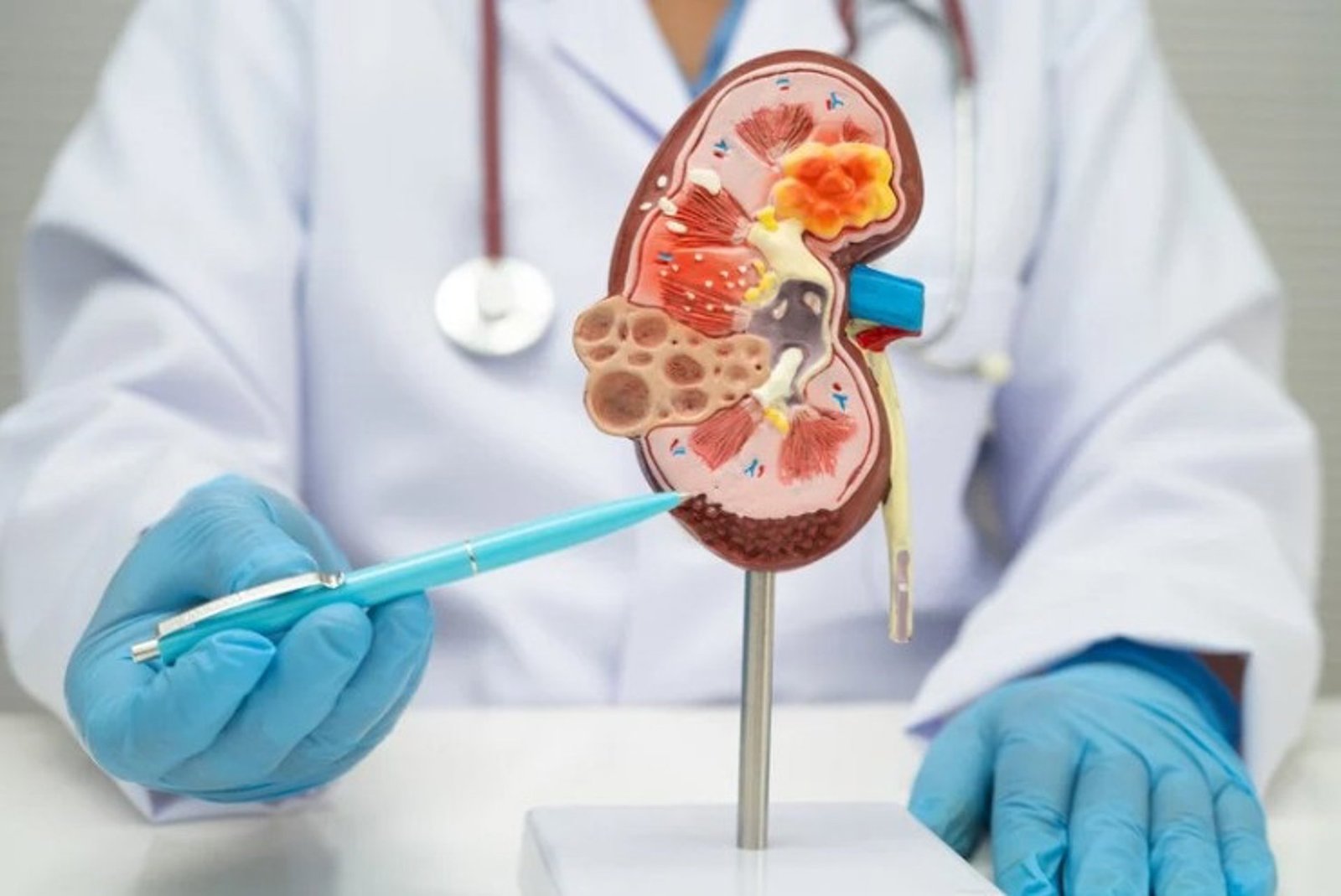 Un estudio alerta del avance de la enfermedad renal crónica entre las mujeres